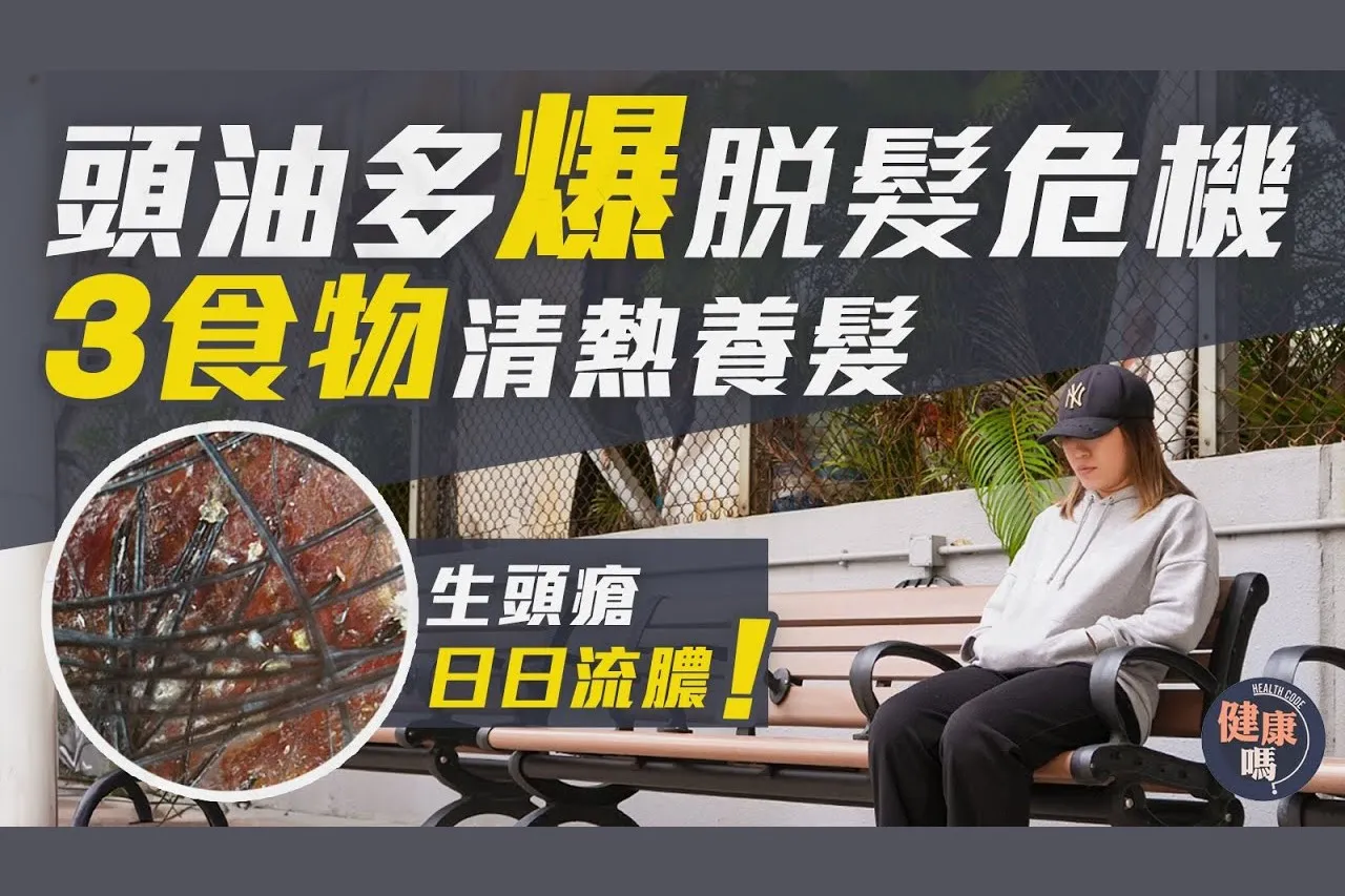 頭油多爆脫髮危機 3食物清熱養髮