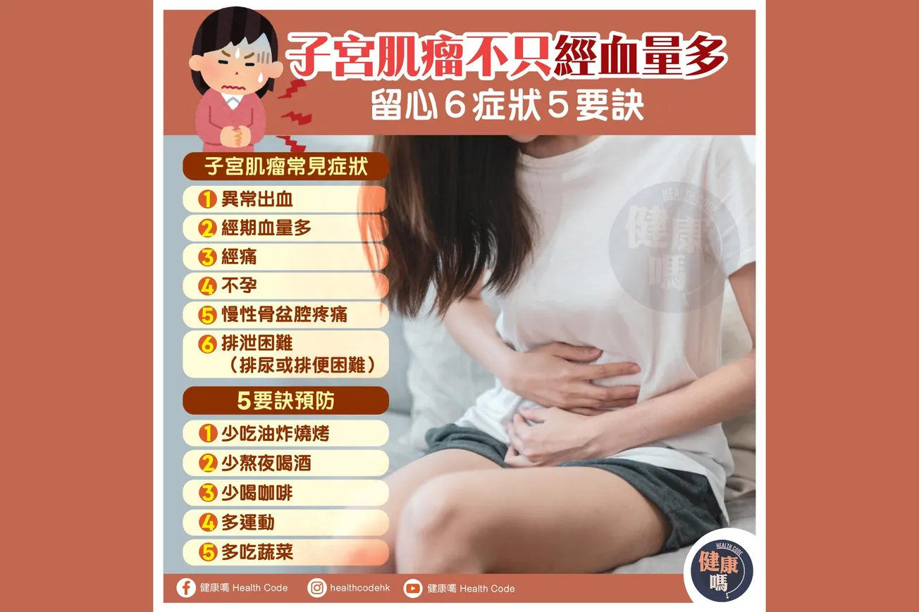 子宮肌瘤不只經血量多 留心6症狀5要訣