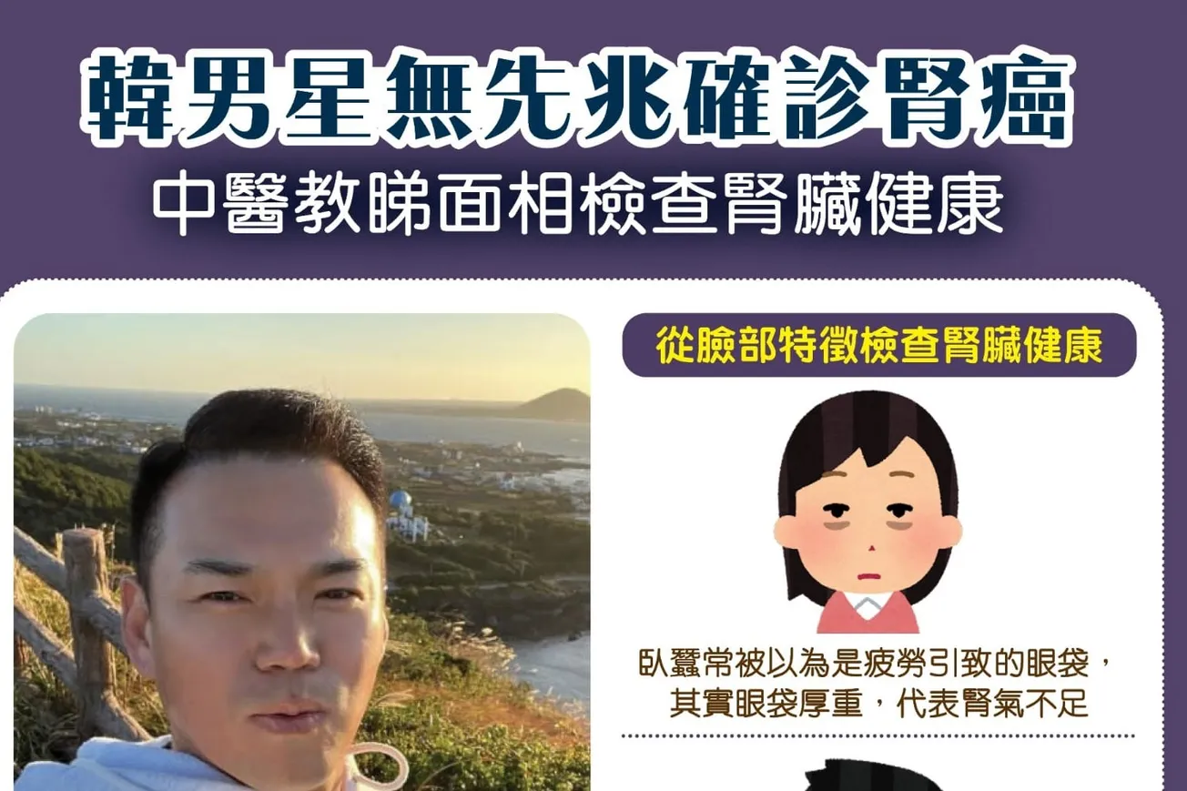 韓男星無先兆確診腎癌 中醫教睇面相檢查腎臟健康