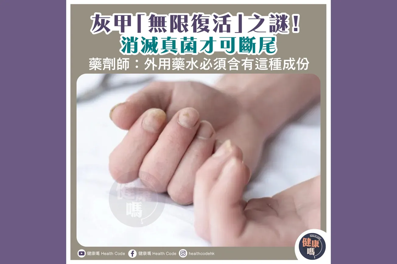 灰甲「無限復活」之謎！消滅真菌才可斷尾  藥劑師：外用藥水必須含有這種成份