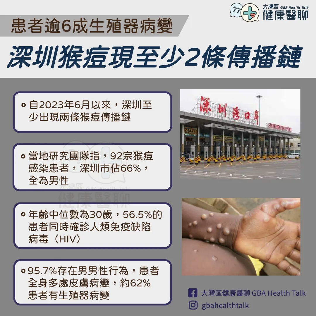 患者逾 6 成生殖器病變 深圳猴痘現至少 2 條傳播鏈