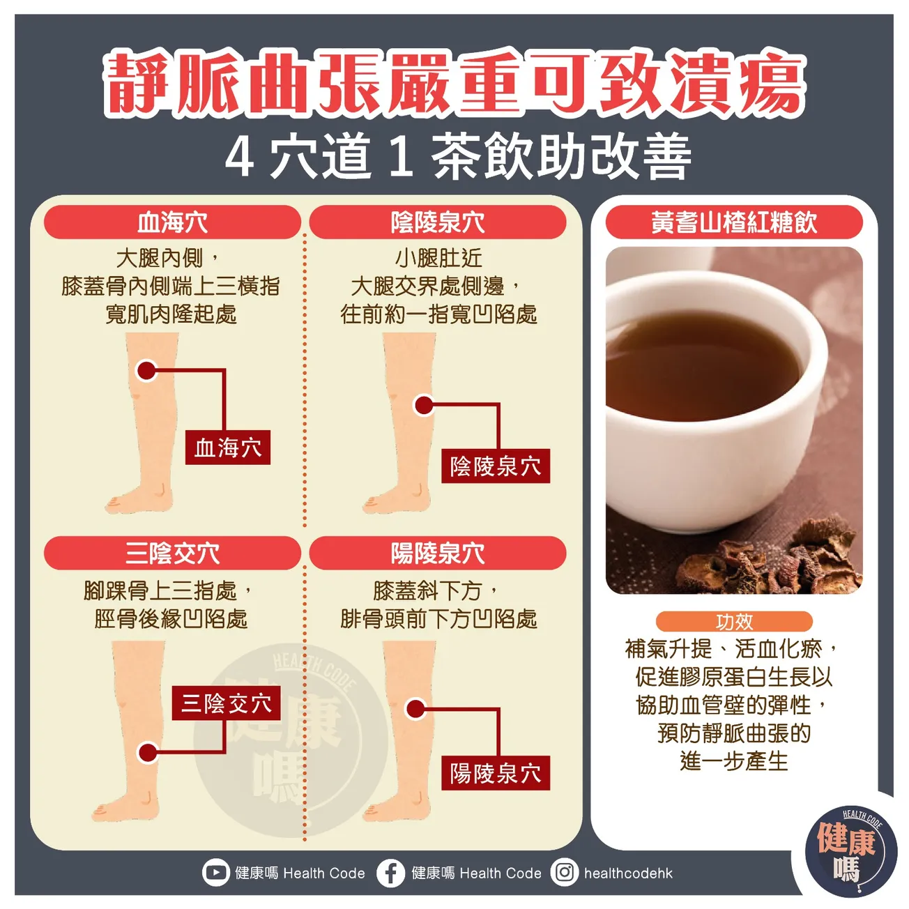 靜脈曲張嚴重可致潰瘍 4 穴道 1 茶飲助改善