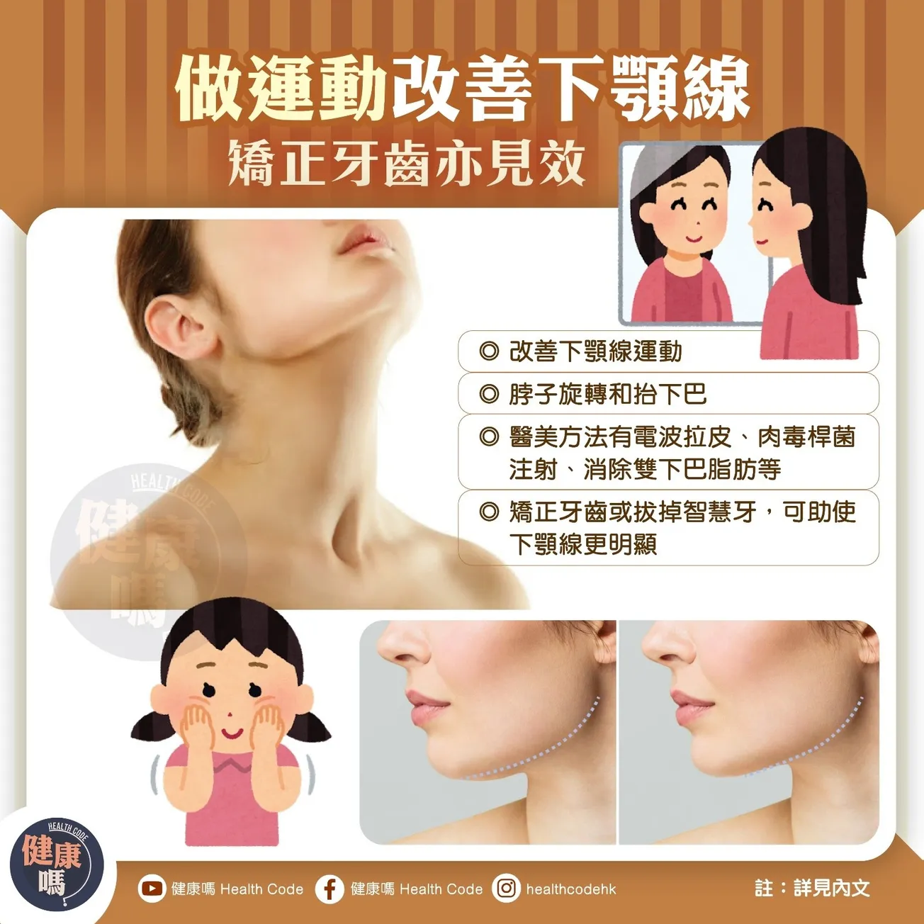 做運動改善下顎線 矯正牙齒亦見效