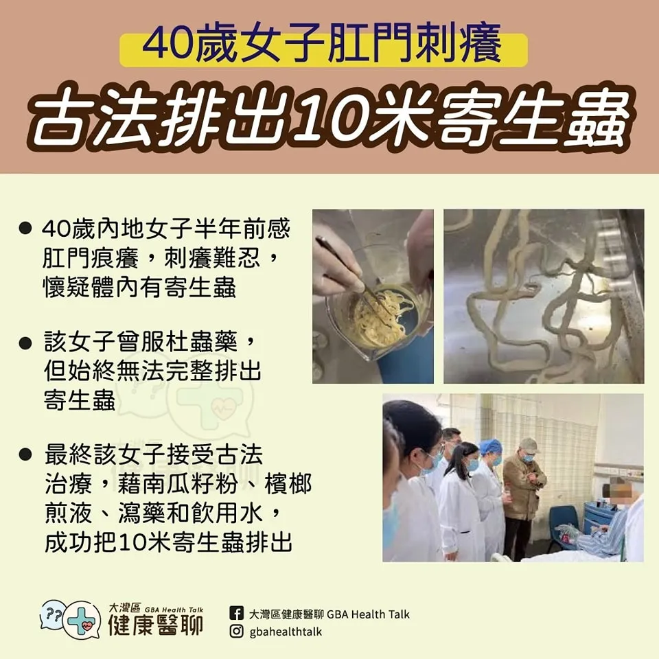 40歲女子肛門刺癢 古法排出 10 米寄生蟲