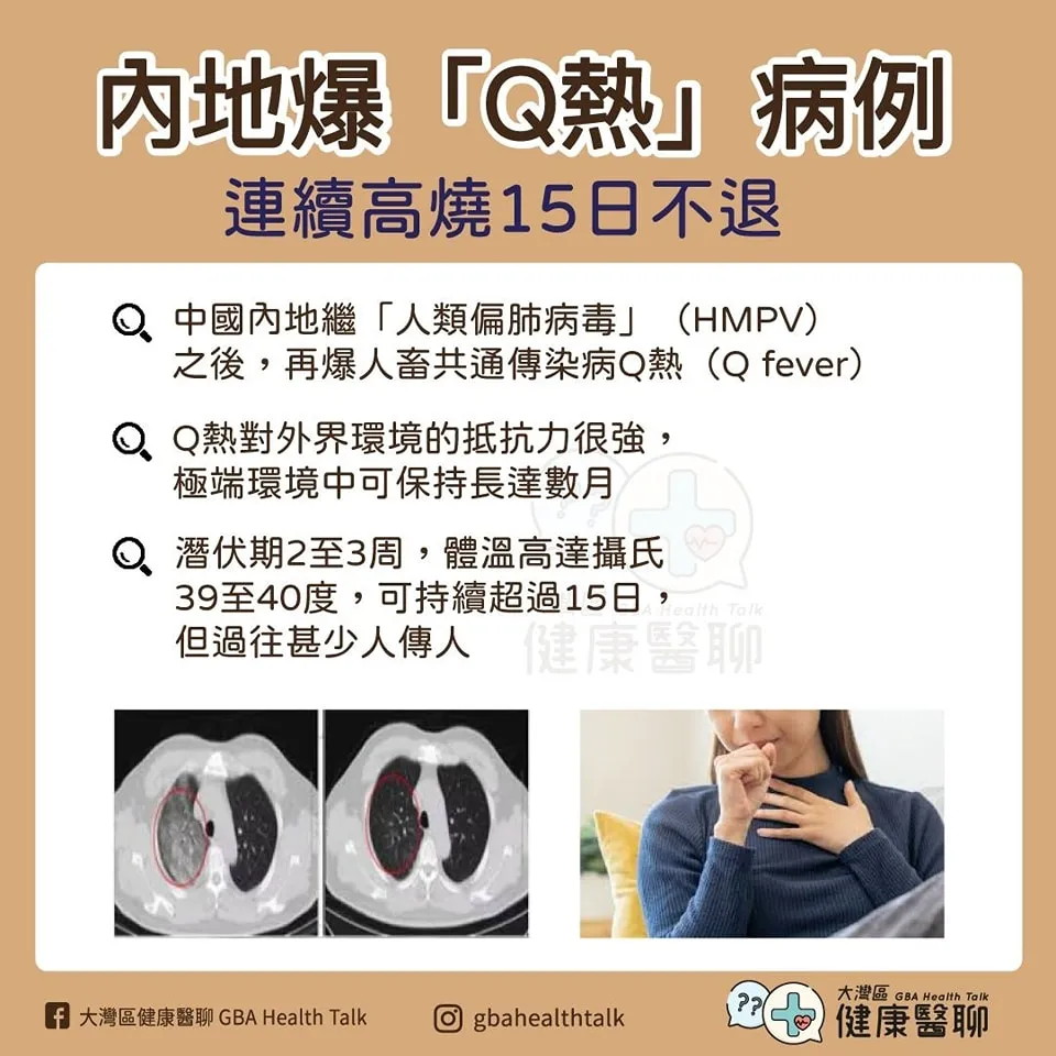 內地爆「Q熱」病例 連續高燒 15日不退