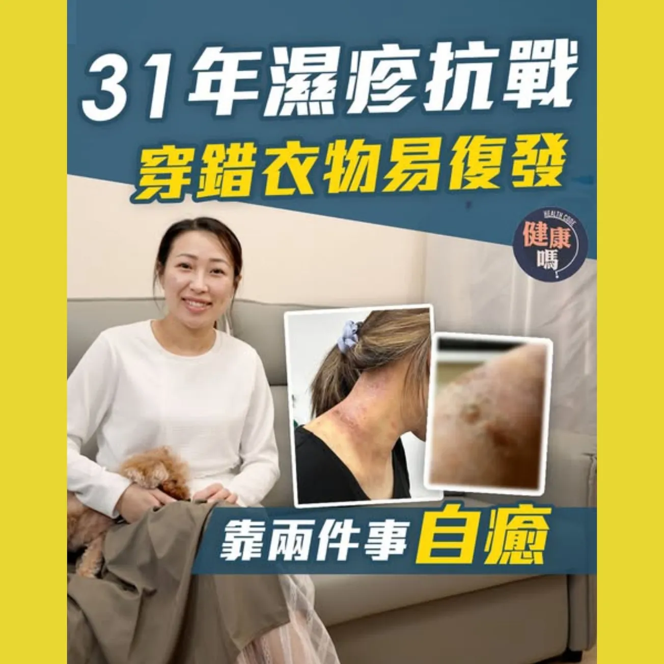 濕疹4年痛不欲生 靠「綁手腳」入睡 做對一些事成功逆轉｜穿錯衣物濕疹惡化 避穿5大物料｜何學工醫生：棉質衣物不適用於所有人