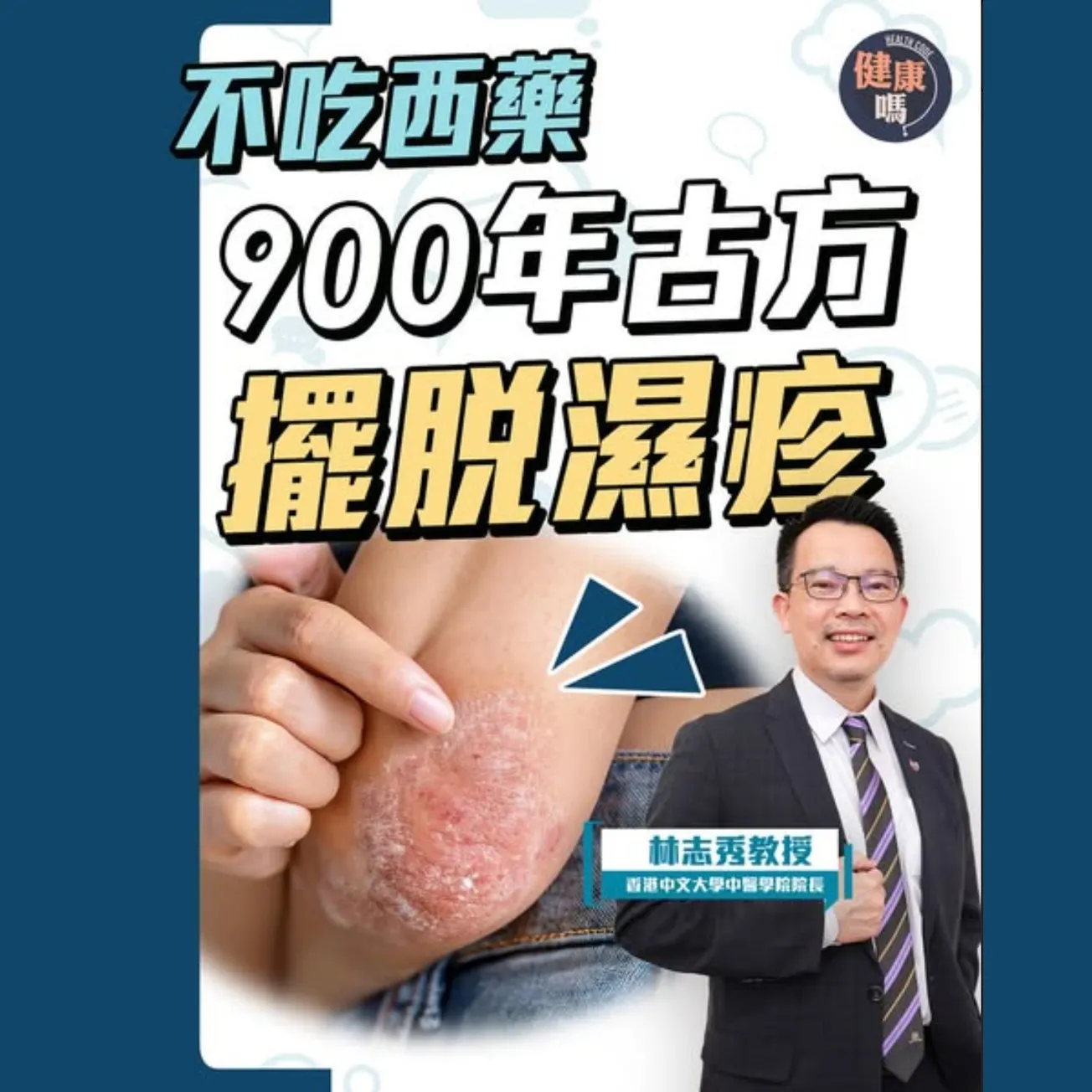 濕疹真相：疫苗惹禍？戒口無用？金銀花沖洗存疑？｜3大不良習慣 害你後天濕疹爆發｜不吃西藥 900年古方擺脫痕癢