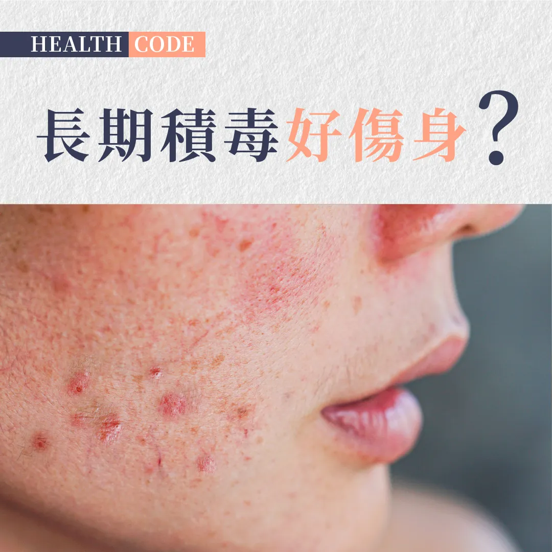 長期痘痘、疲勞、腦霧？ 純天然本草配方 清熱解毒 潤膚養肝