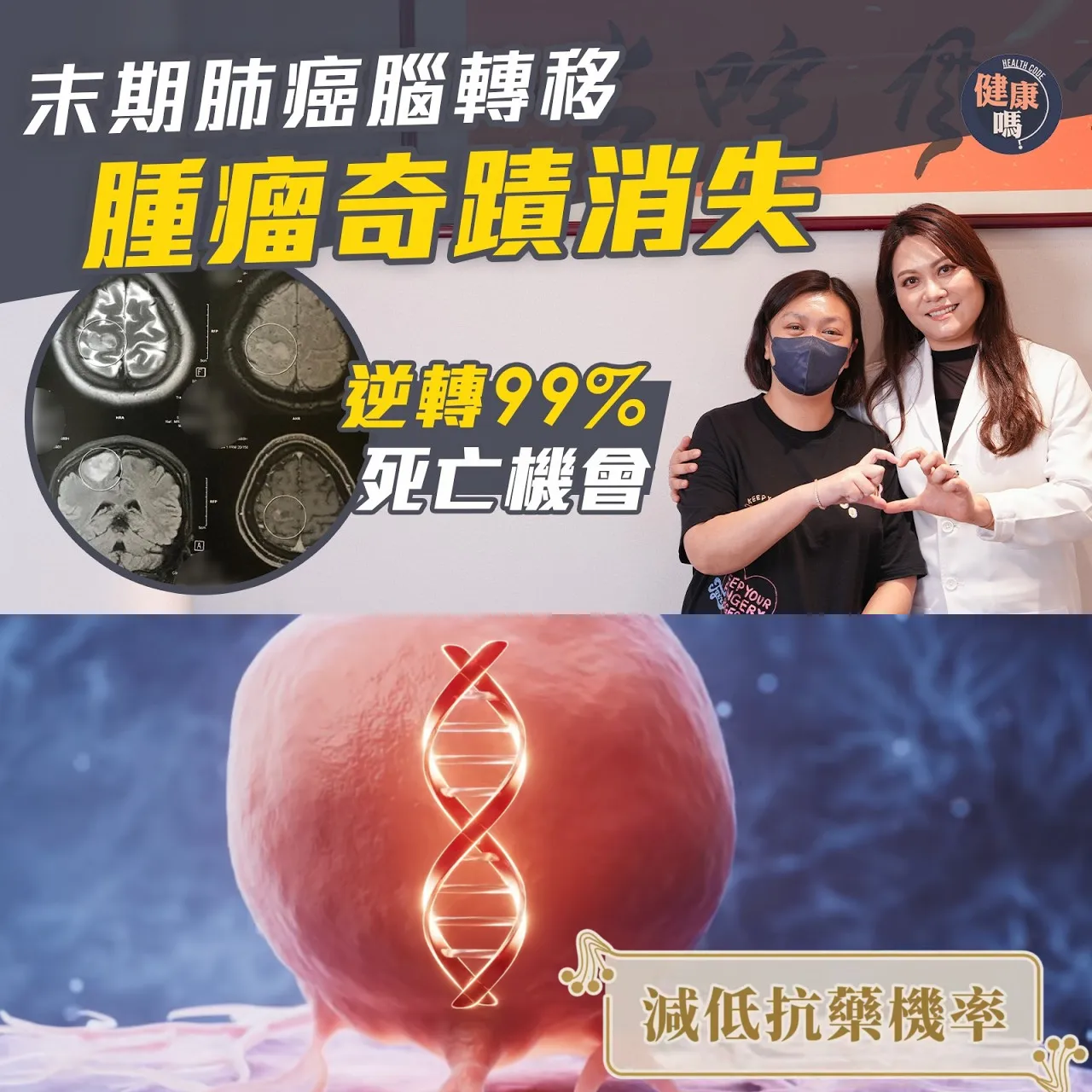 久咳兩個月 揭末期肺癌兼腦轉移 5年存活率僅1%｜標靶藥化療相繼失效 靠中藥消滅癌細胞｜資深中醫師張琛：你不放棄 我不放手