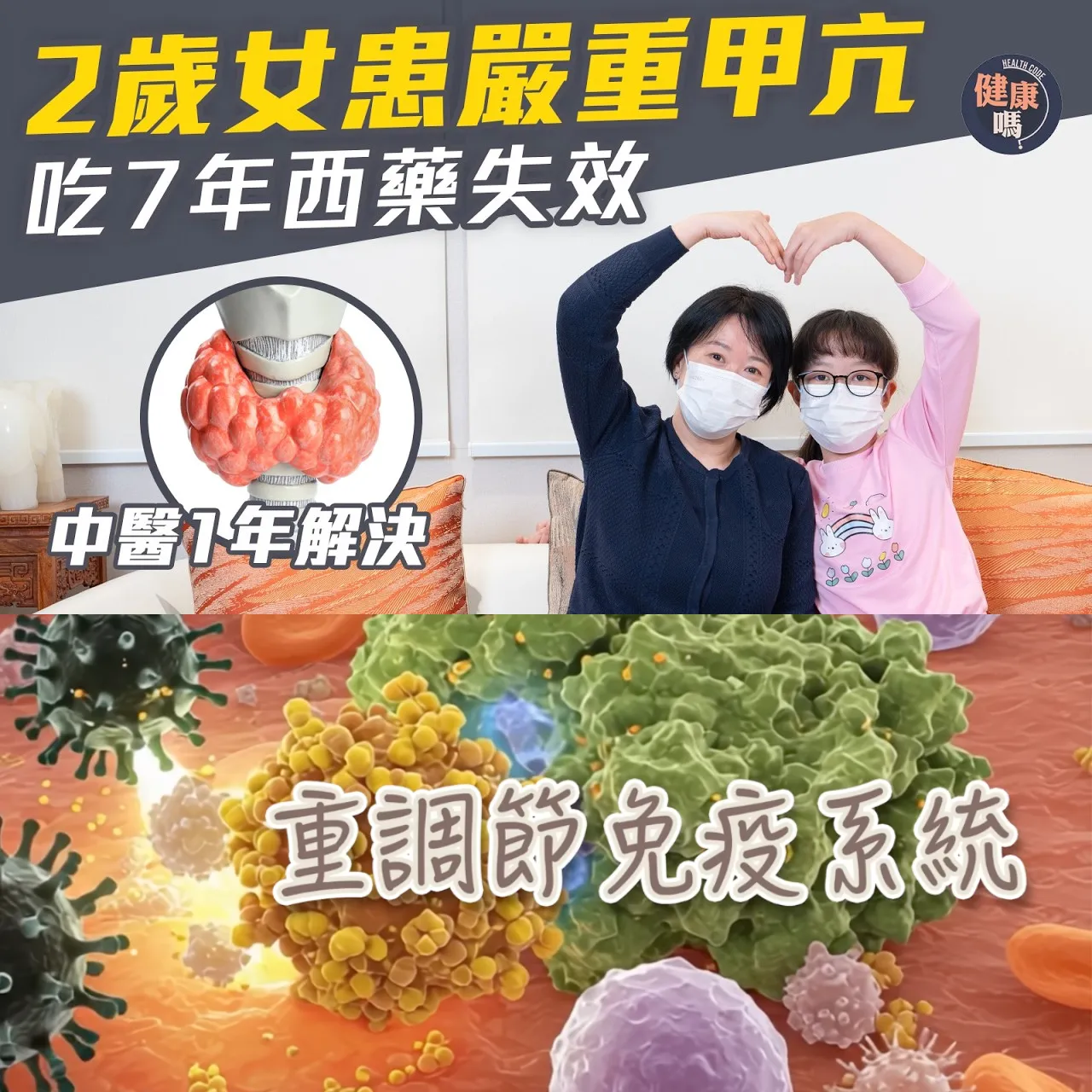 一名2歲兒童被診斷為甲狀腺功能亢進症，並已服用西藥7年